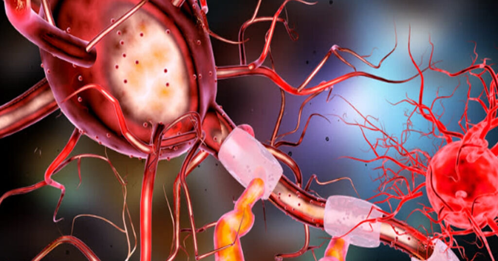 Tratamiento de la leucemia